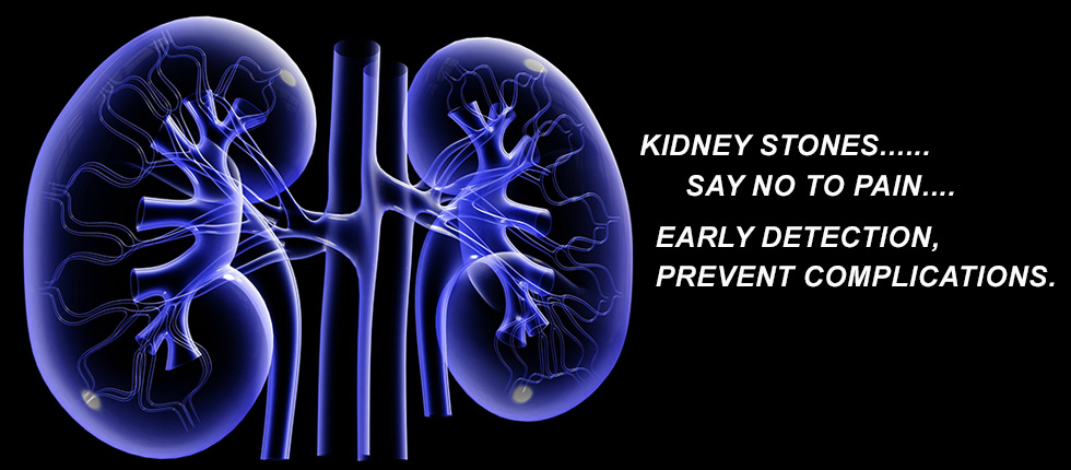 KIDNEY STONE CLINIC